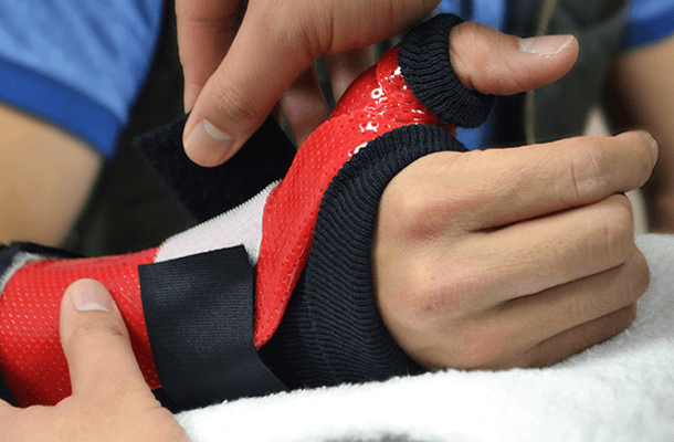 custom hand splints for hand injuries
