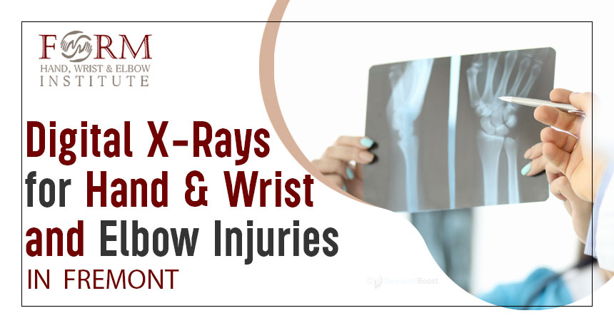 Digital X-Rays for Hand, Wrist, and Elbow Injuries in Fremont