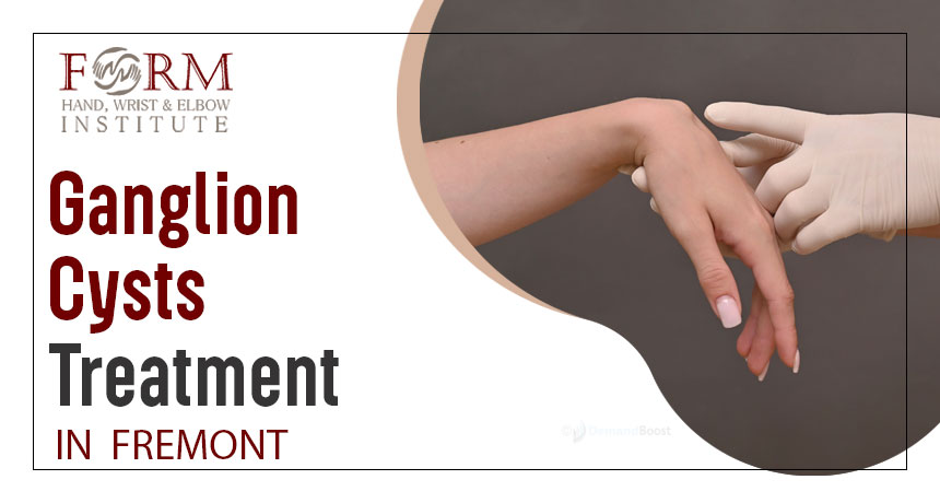 Ganglion Cysts Treatment in Fremont